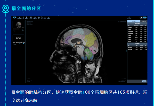 重磅消息！医未医疗获批全国首张阿尔茨海默病AI辅助诊断NMPA三类证