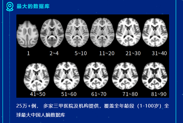 重磅消息！医未医疗获批全国首张阿尔茨海默病AI辅助诊断NMPA三类证