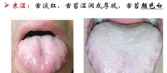 儿童秋季腹泻高发期！家长如何轻松应对？牢记4大点！